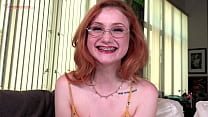 Watch the braces as redhead cute girl Scarlet S... Konulu Porno