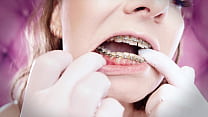 ASMR: upgraded braces with chain-link rubber ba... Konulu Porno