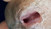 Uretra do penis em close up Konulu Porno